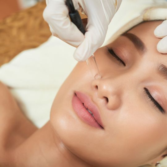 How Long Does Microneedling Results Last?