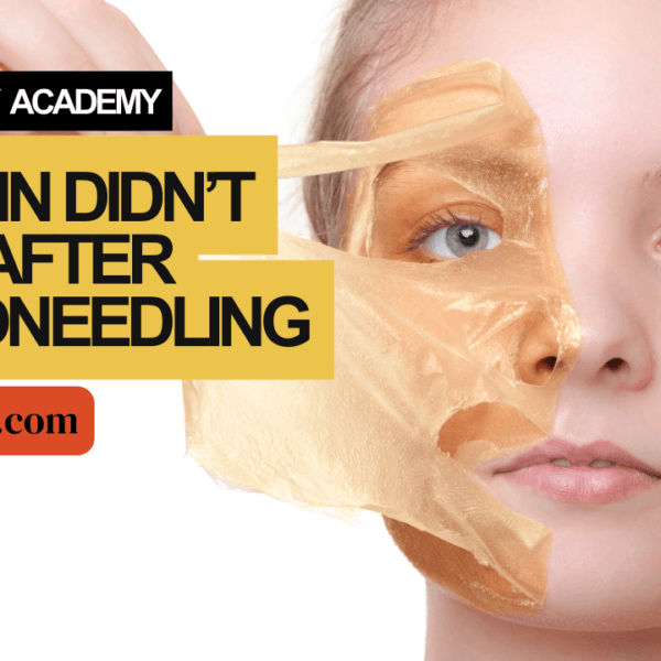 My Skin Didn’t Peel After Microneedling