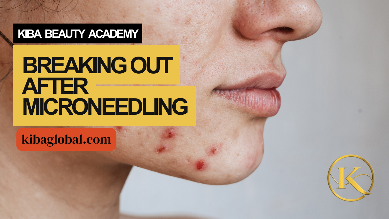 Breaking Out After Microneedling