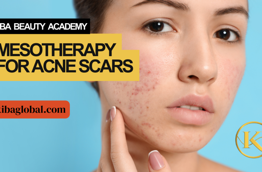 Mesotherapy for Acne Scars
