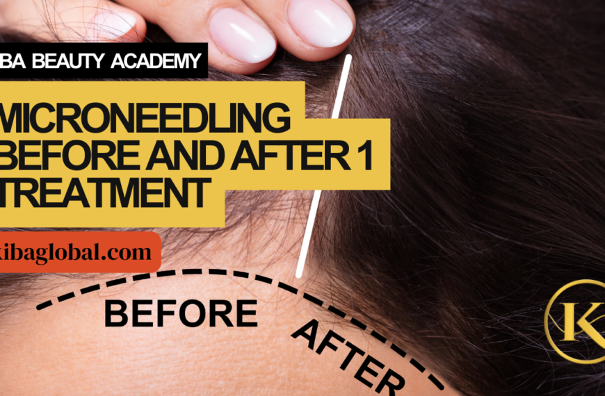 Microneedling Before and After