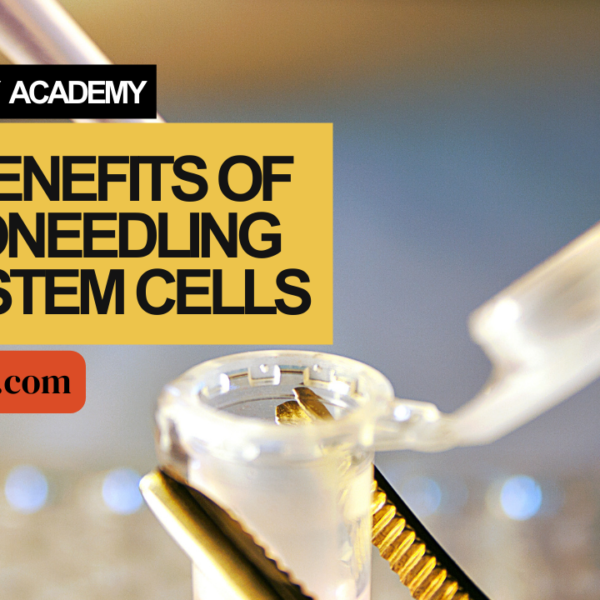 The Benefits of Microneedling With Stem Cells