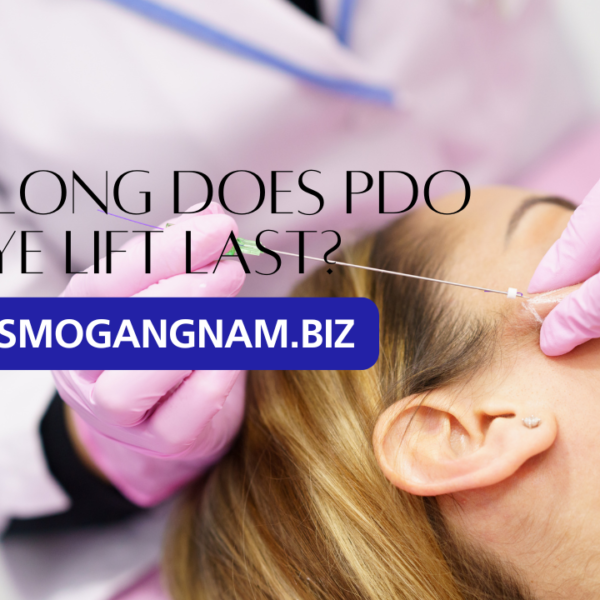 How Long Does PDO Eye Lift Last?