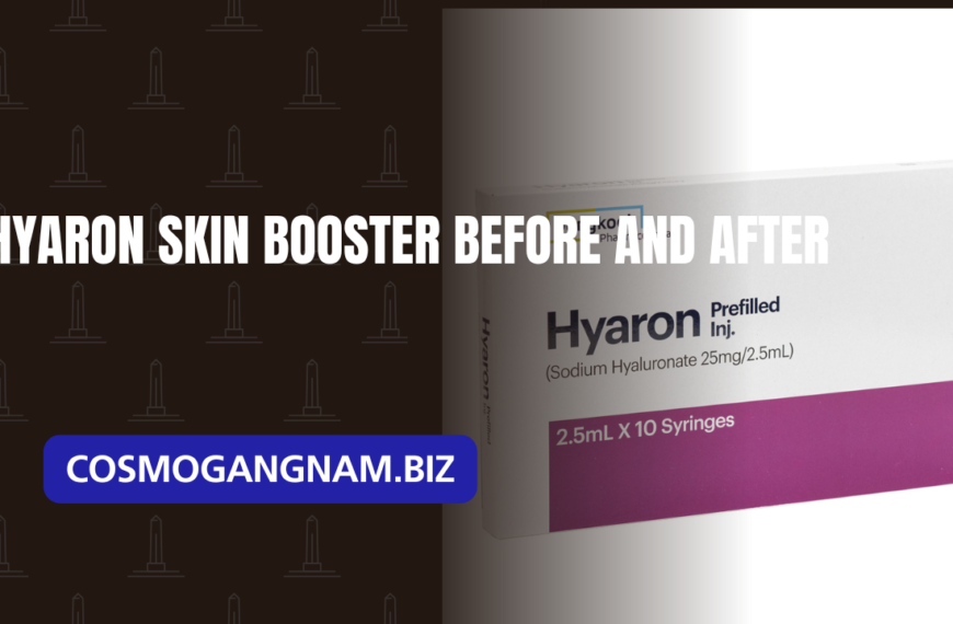 Hyaron skin booster before and after